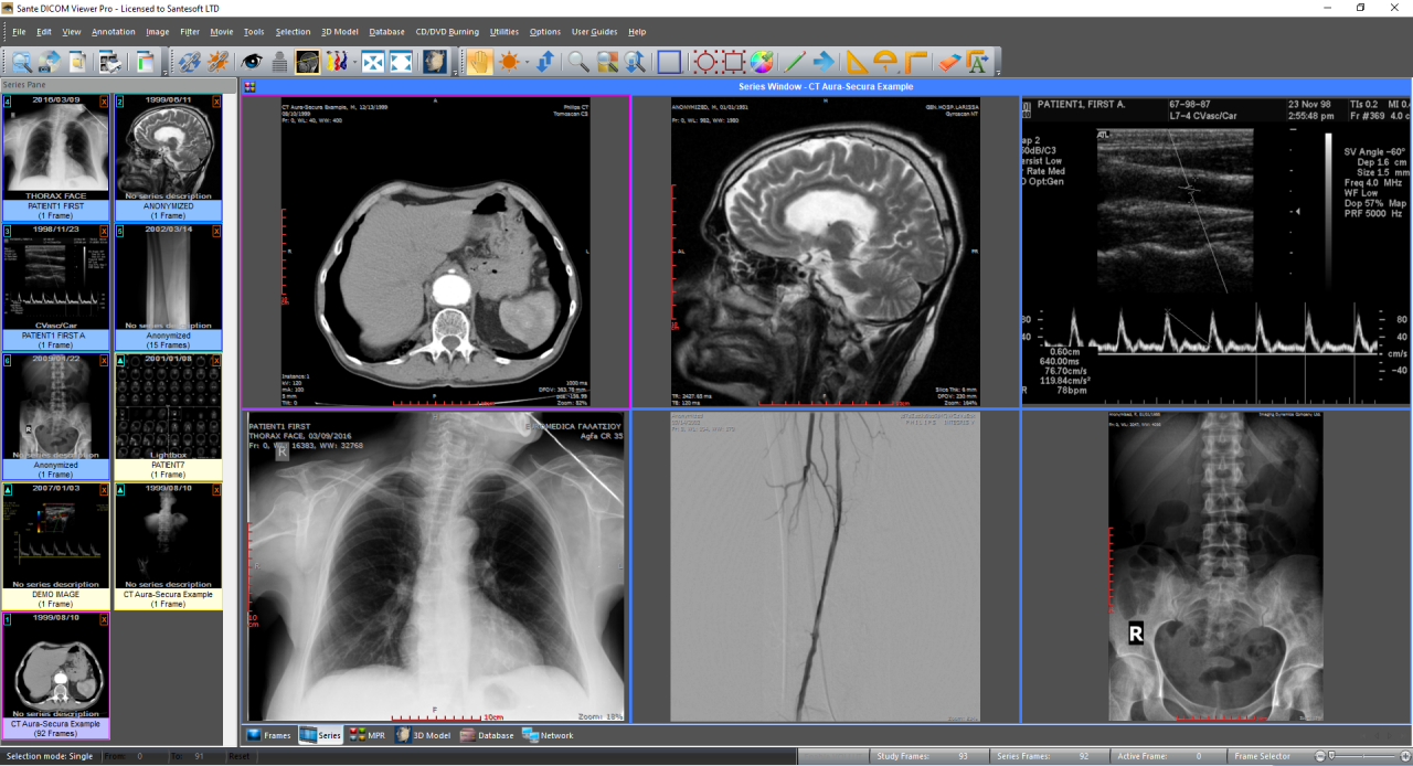 Sante DICOM Viewer Pro 12.2.1 Full